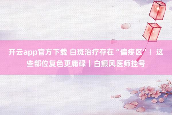 开云app官方下载 白斑治疗存在“偏疼区”！这些部位复色更庸碌丨白癜风医师挂号